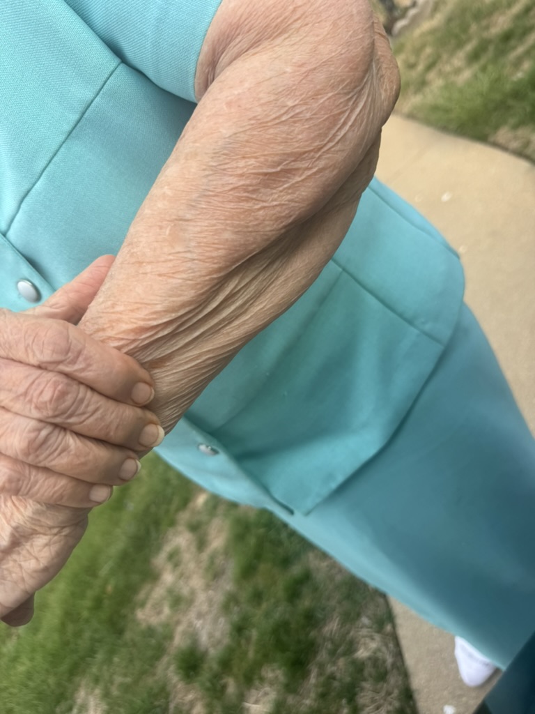 Best Incontinence Products for Seniors: A Caregiver's Honest Guide 1 Elderly hands with watch, senior aging with dignity and grace